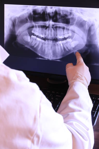 Best Emergency Root Canal Treatment in West Deland, FL