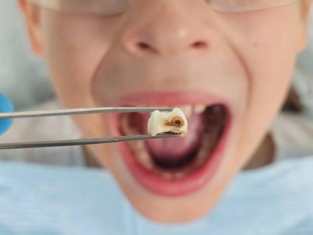 Best Pediatric Emergency Dentist in West Deland, FL