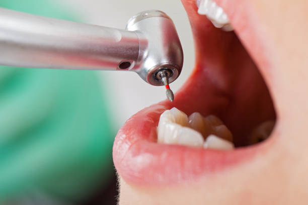 Best Emergency Treatment for Toothache in West Deland, FL